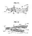 Fig. 17 - Oral care device