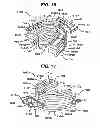 Fig. 18 - Oral care device