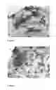 Fig. 07 - Device and method for non-invasive collection of colorectal mucocellular layer and disease detection