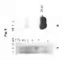Fig. 09 - SUPPRESSION OF TLA1 GENE EXPRESSION FOR IMPROVED PHOTOSYNTHETIC PRODUCTIVITY