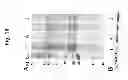 Fig. 11 - SUPPRESSION OF TLA1 GENE EXPRESSION FOR IMPROVED PHOTOSYNTHETIC PRODUCTIVITY