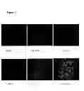 Fig. 07 - TUMOUR CELL AND TISSUE CULTURE