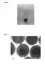 Fig. 04 - CROSS-LINKED POLY-E-LYSINE PARTICLES