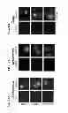 Fig. 19 - Photocleavable linker