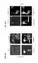 Fig. 24 - Photocleavable linker
