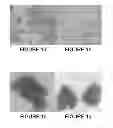 Fig. 02 - Method of obtaining circulating cancer cell populations