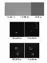 Fig. 03 - Method of obtaining circulating cancer cell populations