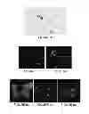 Fig. 04 - Method of obtaining circulating cancer cell populations