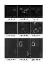 Fig. 05 - Method of obtaining circulating cancer cell populations