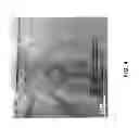 Fig. 04 - Dislocation engineering using a scanned laser