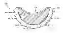 Fig. 01 - WIRELESS HANDS FREE DEVICE FOR EQUESTRIAN RIDING ACTIVITIES