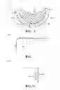 Fig. 02 - WIRELESS HANDS FREE DEVICE FOR EQUESTRIAN RIDING ACTIVITIES