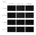 Fig. 07 - System for identification of microorganism and detection of infectious disease