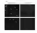Fig. 09 - System for identification of microorganism and detection of infectious disease
