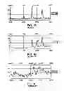Fig. 03 - IDENTIFICATION OF BIOMARKERS FOR DETECTING PROSTATE CANCER