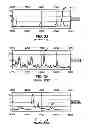 Fig. 07 - IDENTIFICATION OF BIOMARKERS FOR DETECTING PROSTATE CANCER