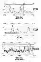 Fig. 10 - IDENTIFICATION OF BIOMARKERS FOR DETECTING PROSTATE CANCER