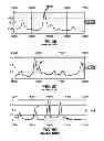 Fig. 11 - IDENTIFICATION OF BIOMARKERS FOR DETECTING PROSTATE CANCER