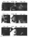 Fig. 04 - CURABLE BONE SUBSTITUTE