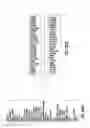 Fig. 42 - EMT SIGNATURES AND PREDICTIVE MARKERS AND METHOD OF USING THE SAME