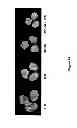 Fig. 20 - Compounds and Methods for Treating Cancer and Diseases of the Central Nervous System
