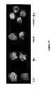 Fig. 25 - Compounds and Methods for Treating Cancer and Diseases of the Central Nervous System