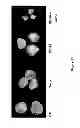 Fig. 27 - Compounds and Methods for Treating Cancer and Diseases of the Central Nervous System