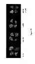 Fig. 31 - Compounds and Methods for Treating Cancer and Diseases of the Central Nervous System