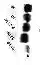 Fig. 09 - Micro-RNA's that regulate muscle cells
