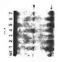 Fig. 35 - Micro-RNA's that regulate muscle cells