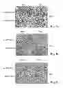 Fig. 08 - PROMOTERS EXHIBITING ENDOTHELIAL CELL SPECIFICITY AND METHODS OF USING SAME FOR REGULATION OF ANGIOGENESIS