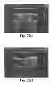Fig. 28 - PROMOTERS EXHIBITING ENDOTHELIAL CELL SPECIFICITY AND METHODS OF USING SAME FOR REGULATION OF ANGIOGENESIS