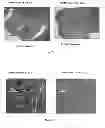 Fig. 63 - PROMOTERS EXHIBITING ENDOTHELIAL CELL SPECIFICITY AND METHODS OF USING SAME FOR REGULATION OF ANGIOGENESIS