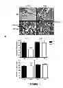 Fig. 12 - METHOD FOR CORRECTING A LIPID IMBALANCE IN A SUBJECT