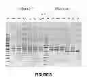 Fig. 06 - ANTISENSE OLIGONUCLEOTIDES FOR INDUCING EXON SKIPPING AND METHODS OF USE THEREOF