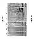Fig. 20 - ANTISENSE OLIGONUCLEOTIDES FOR INDUCING EXON SKIPPING AND METHODS OF USE THEREOF