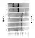 Fig. 21 - ANTISENSE OLIGONUCLEOTIDES FOR INDUCING EXON SKIPPING AND METHODS OF USE THEREOF