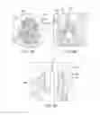 Fig. 08 - Treatment of anxiety disorders by external application of ionizing radiation