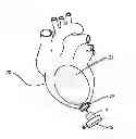 Fig. 01 - Apical ring for ventricular assist device