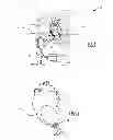 Fig. 02 - Apical ring for ventricular assist device