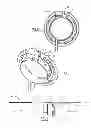 Fig. 04 - Apical ring for ventricular assist device