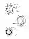 Fig. 05 - Apical ring for ventricular assist device