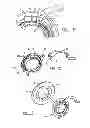 Fig. 06 - Apical ring for ventricular assist device