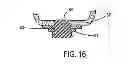 Fig. 08 - Apical ring for ventricular assist device