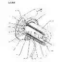 Fig. 03 - Cardiac pump