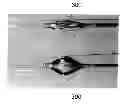 Fig. 01 - METHOD FOR INCREASED UPTAKE OF BENEFICIAL AGENT AND EJECTION FRACTION BY POSTCONDITIONING PROCEDURES