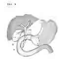 Fig. 16 - Treatment method