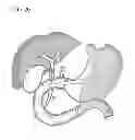 Fig. 20 - Treatment method