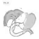 Fig. 22 - Treatment method
