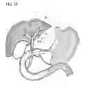 Fig. 23 - Treatment method